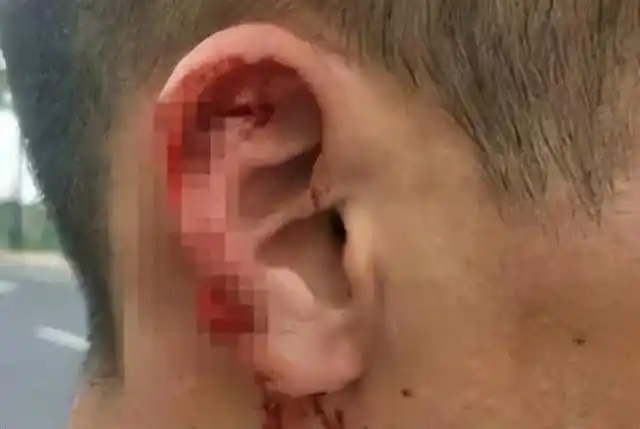 高速碰瓷 防范技巧 _宝安沙井碰瓷_ 春节高速安全驾驶