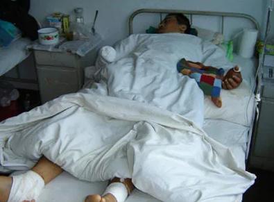 长春砍手门到底有没有处理结果_吴天昊郝志鹏篮球场冲突细节_长春砍手门事件真相