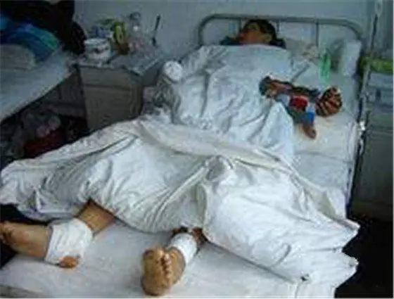 长春砍手案_篮球场暴力事件_长春砍手门到底有没有处理结果