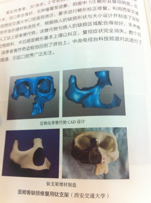3D打印应用领域_3D打印技术原理_3d打印笔结构