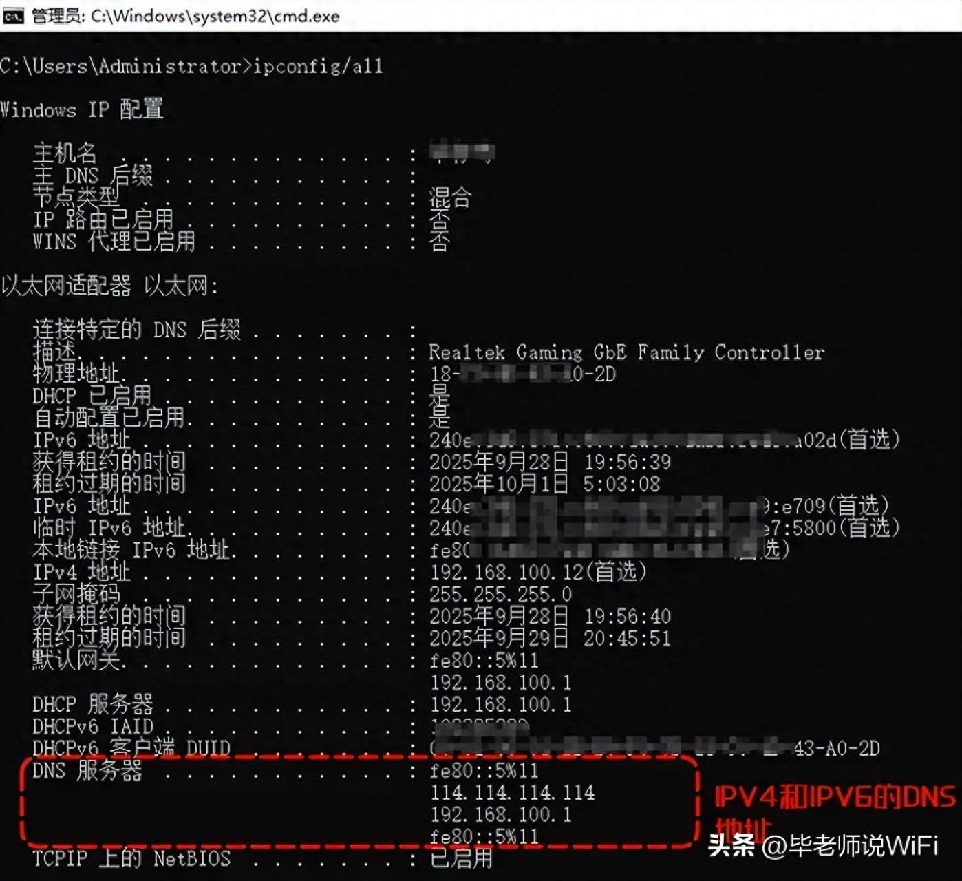 DNS的服务器IP地址在哪里看？