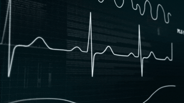 熬夜猝死风险因素_熬夜引发心源性猝死危险信号_熬夜到什么程度?医生划出4条红线