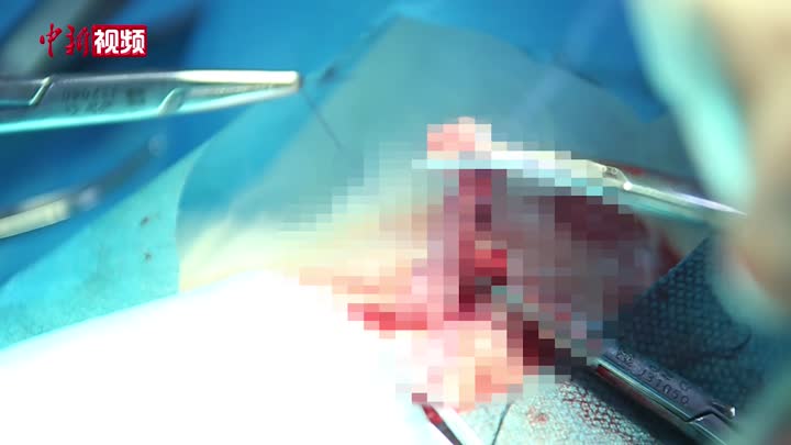 上海免费为流浪猫狗绝育 救助者：值得推广