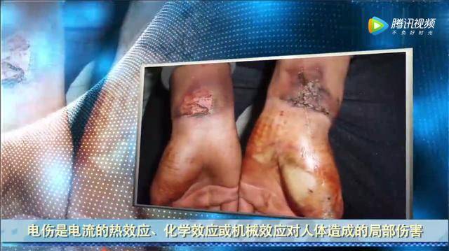 临时用电事故类型触电伤害电伤_电气火灾原因及预防_临时用电注意事项漫画图片