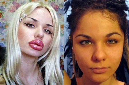 俄女孩丰唇100次为拥有性感双唇(图)