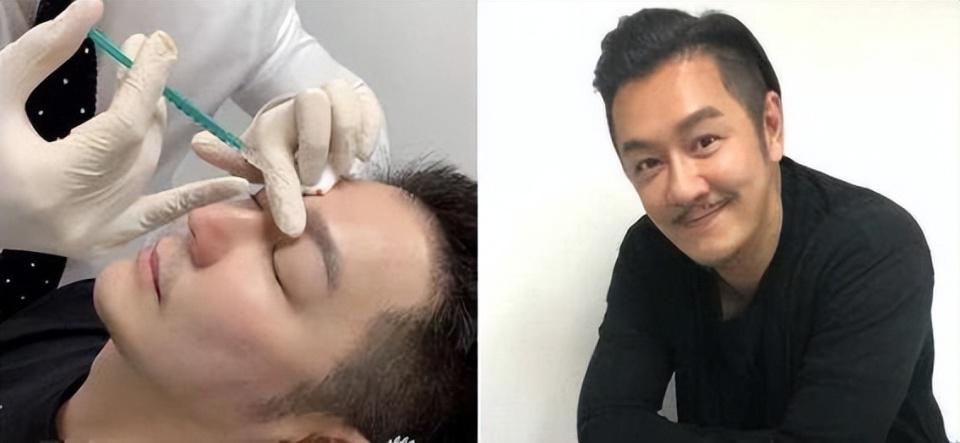 56岁陈浩民现身福建街头显沧桑_陈浩民不老男神_陈浩民医美前后对比