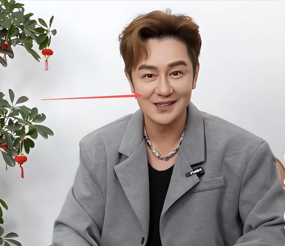 陈浩民医美前后对比_陈浩民不老男神_56岁陈浩民现身福建街头显沧桑