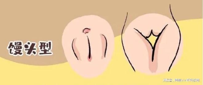 女生私处小花瓣形状_私处花瓣常见外观类型_阴部图片