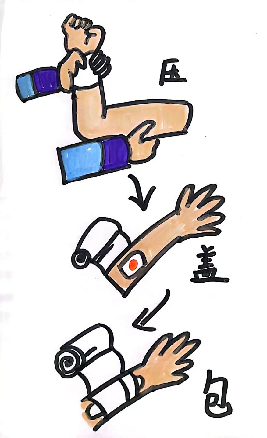 正确止血方法_毛细血管出血处理_止血带充气时间