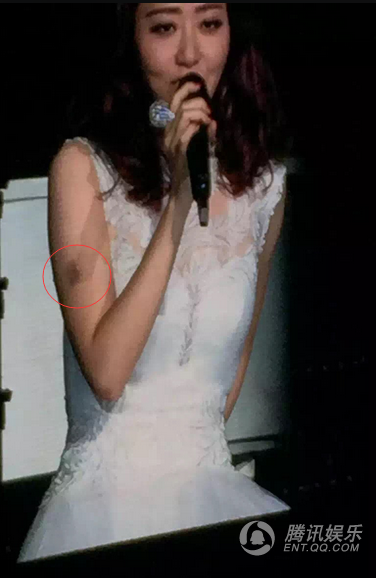 张靓颖就医照曝光 男友冯珂护送神色不安