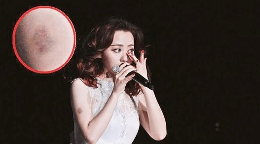 演艺安全活动监管_张靓颖演唱会摔下两米高舞台_明星演唱会现场事故