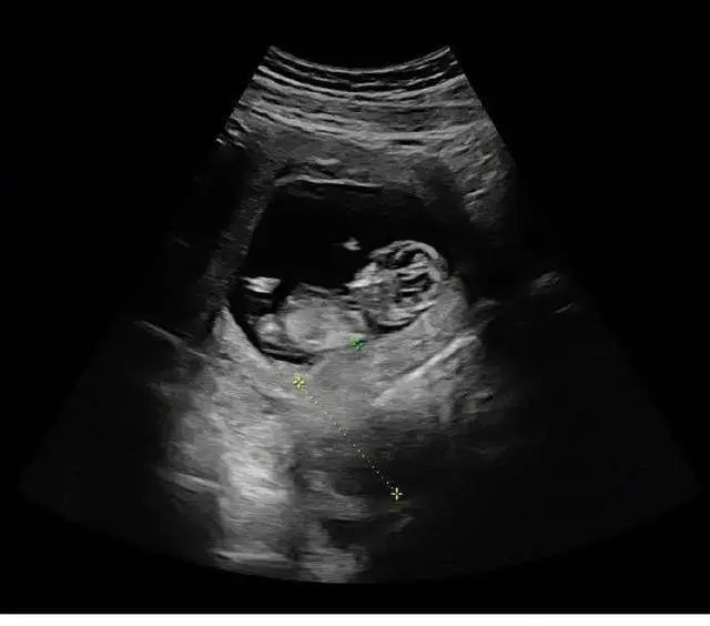 杨祐宁最新动态_杨祐宁父亲离世_杨祐宁升级当爸爸