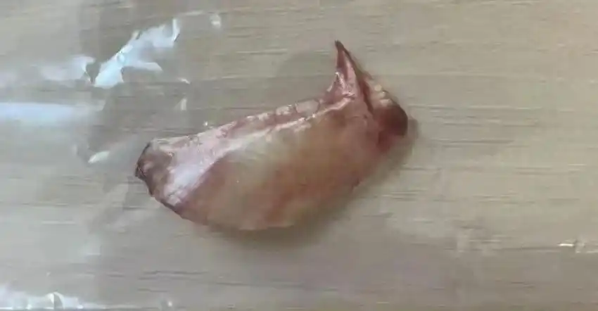 直插心脏！男子吃饭时一个动作险些丧命！很多人都有误区