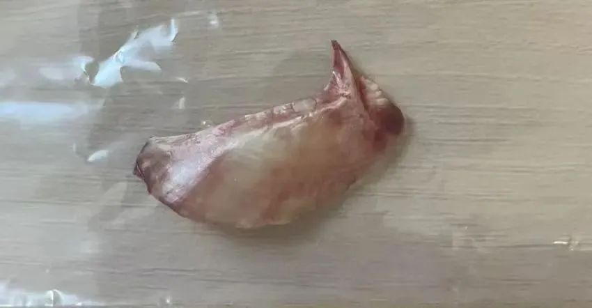 鱼刺卡喉误吞后果_男子鱼刺卡喉后身亡工伤诉求遭驳回_鱼刺卡喉处理方法