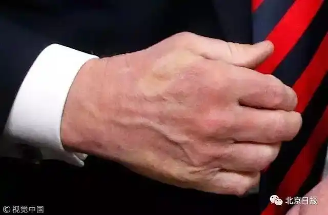 特朗普握手特点_特朗普马克龙握手_特朗普马克龙26秒“掰手腕式握手”