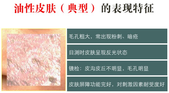 干性肌肤面膜推荐_最新推出的我的美丽日记面膜_油性肌肤控油面膜