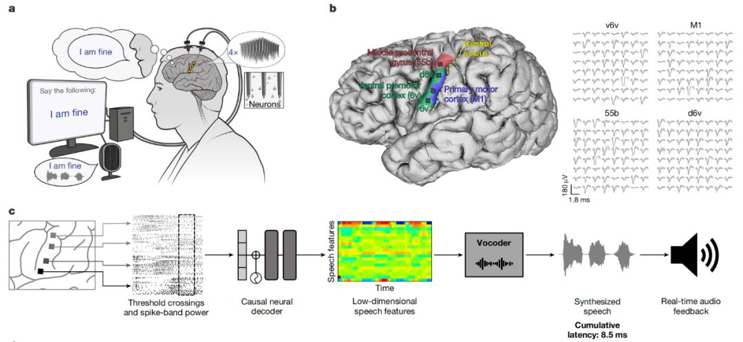 脑机接口让渐冻症患者成功自主进食_脑机接口瘫痪者说话_脑机接口渐冻症语音合成