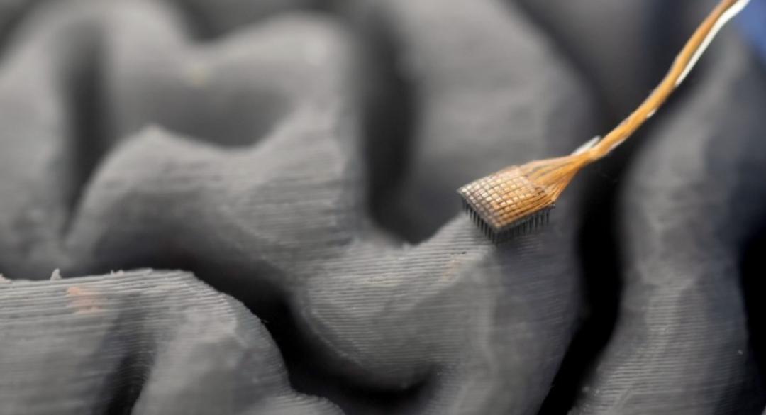 脑机接口瘫痪者说话_脑机接口让渐冻症患者成功自主进食_脑机接口渐冻症语音合成