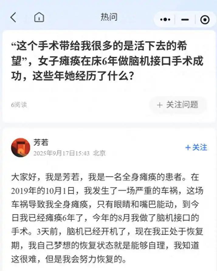 脑机接口让渐冻症患者成功自主进食_脑机接口意念控制手_车祸瘫痪脑机接口手术