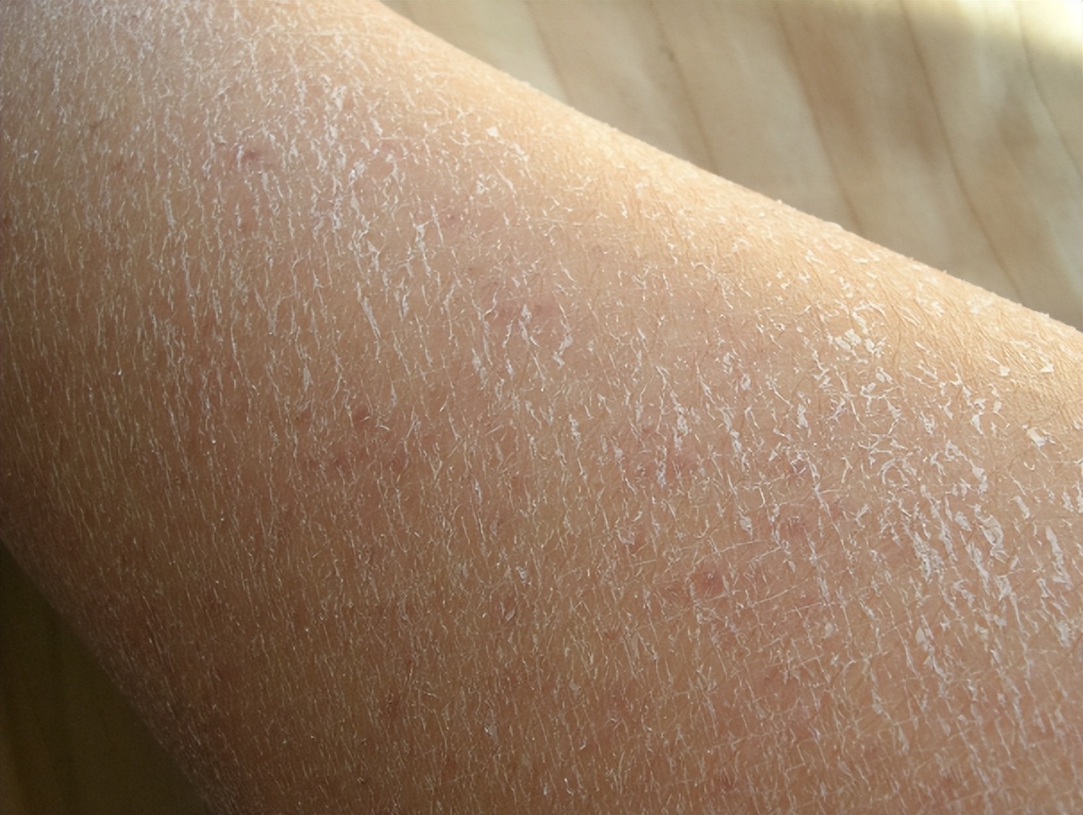 洗澡用什么洗最好_冬天洗澡多久一次合适_冬季洗澡频率与安全