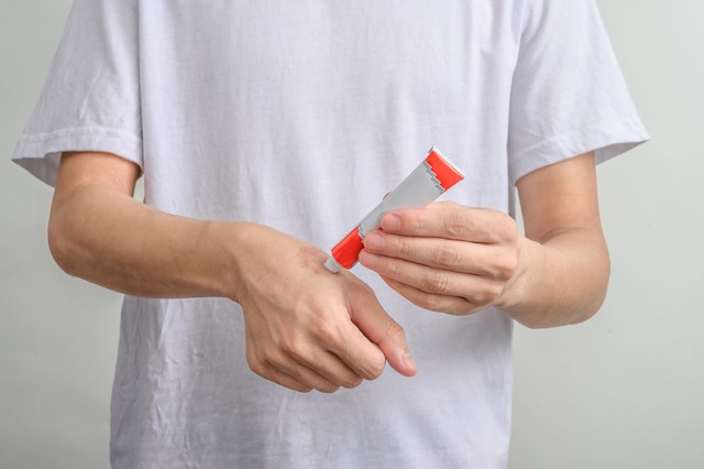 皮肤病外用药膏_常用皮肤病药膏类型_股藓 用什么洗澡