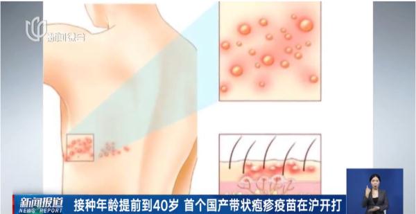 上海就诊人数明显增多!此病进入高发期,一旦感染……