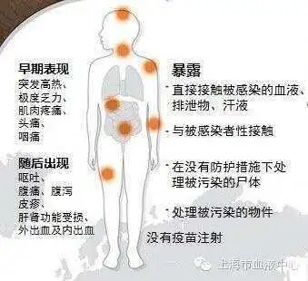 刚果金埃博拉疫情最新进展_埃博拉病毒时事评论_世卫组织埃博拉疫苗接种情况