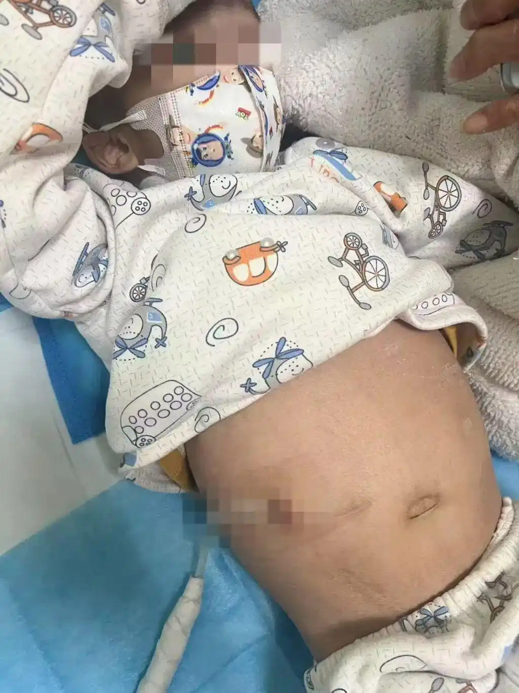 试管婴儿肾病综合征遗传基因检查_试管婴儿患肾病 父母要求医院担全责_试管婴儿医院遗传咨询过错