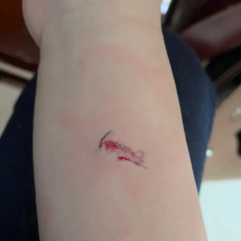 被宠物抓伤处理方法_狂犬疫苗注射指南_老鼠抓的伤口图片