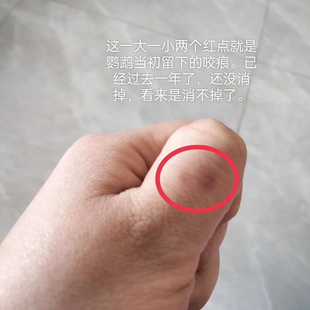 老鼠抓的伤口图片_狂犬疫苗注射指南_被宠物抓伤处理方法