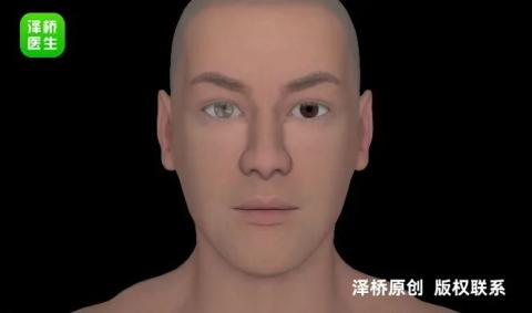 年轻人也会脑卒中？这些症状要警惕_过度劳累脑梗风险_年轻人血管堵塞