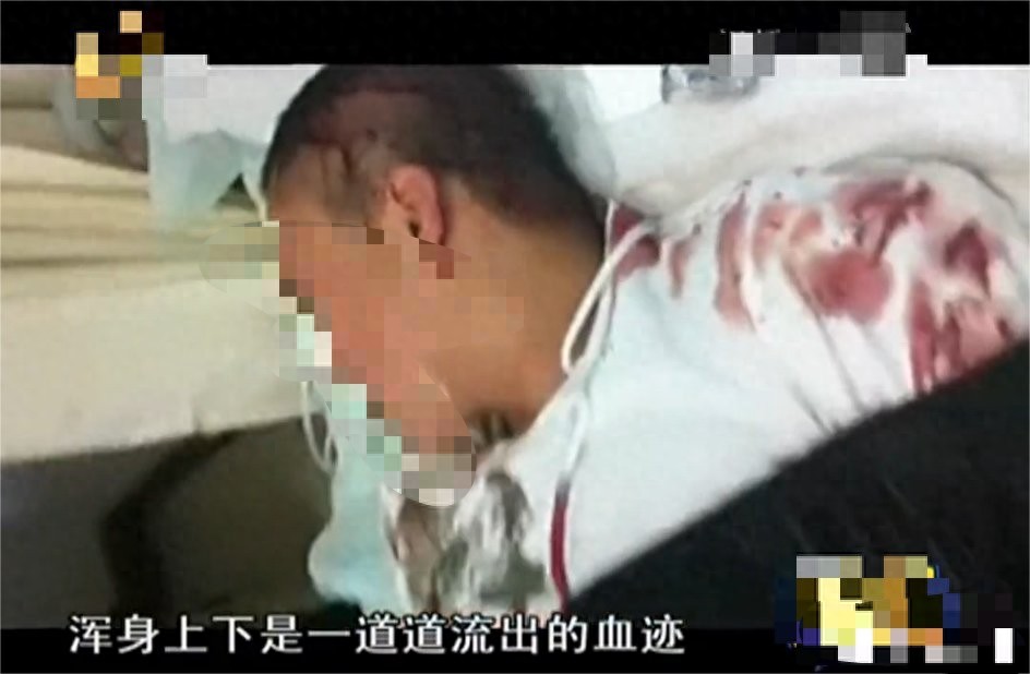 2011年，少年与富二代发生冲突，后被对方父母叫人砍断双手丧命