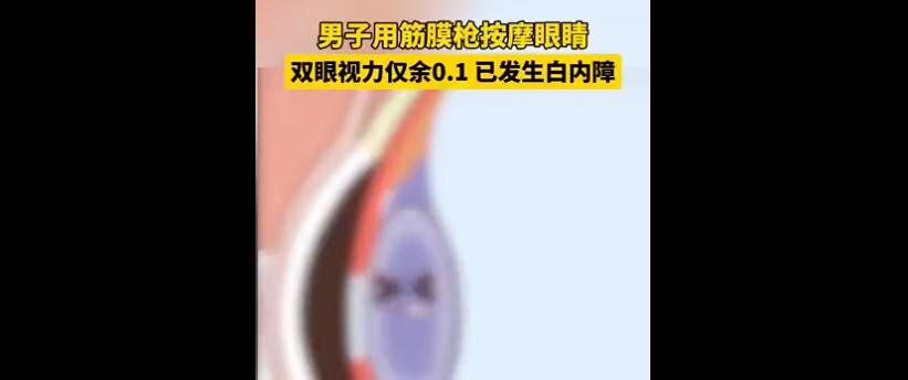 险些失明！切勿乱用筋膜枪→