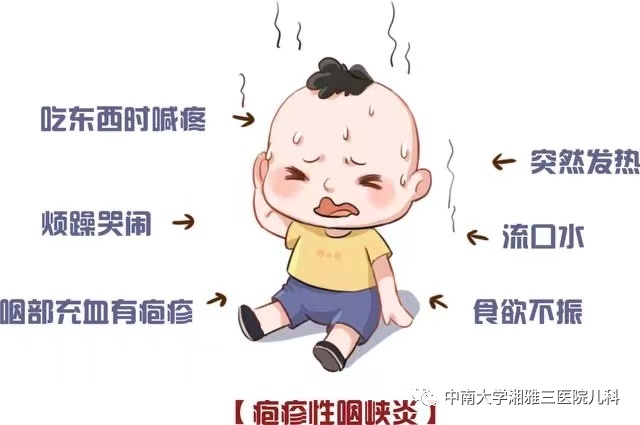 流感毒株变了！中疾控提醒_嗓子疼 新冠 新毒株