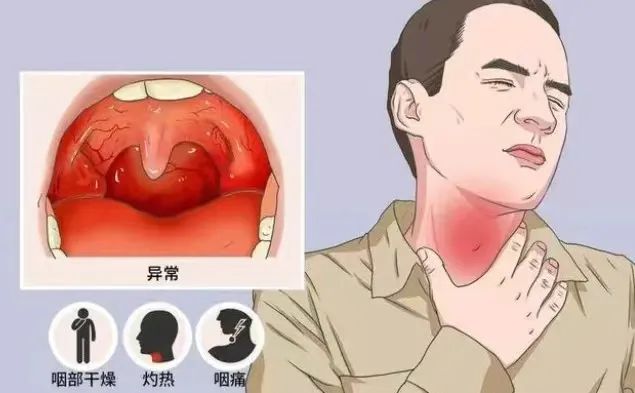 嗓子疼 新冠 新毒株_流感毒株变了！中疾控提醒